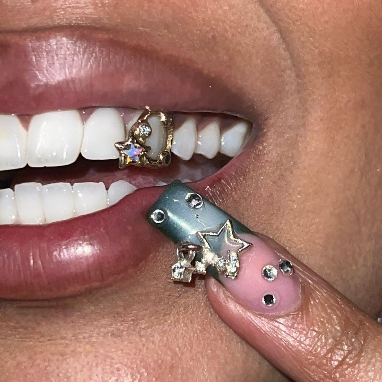 STAR GARDEN GRILLZ