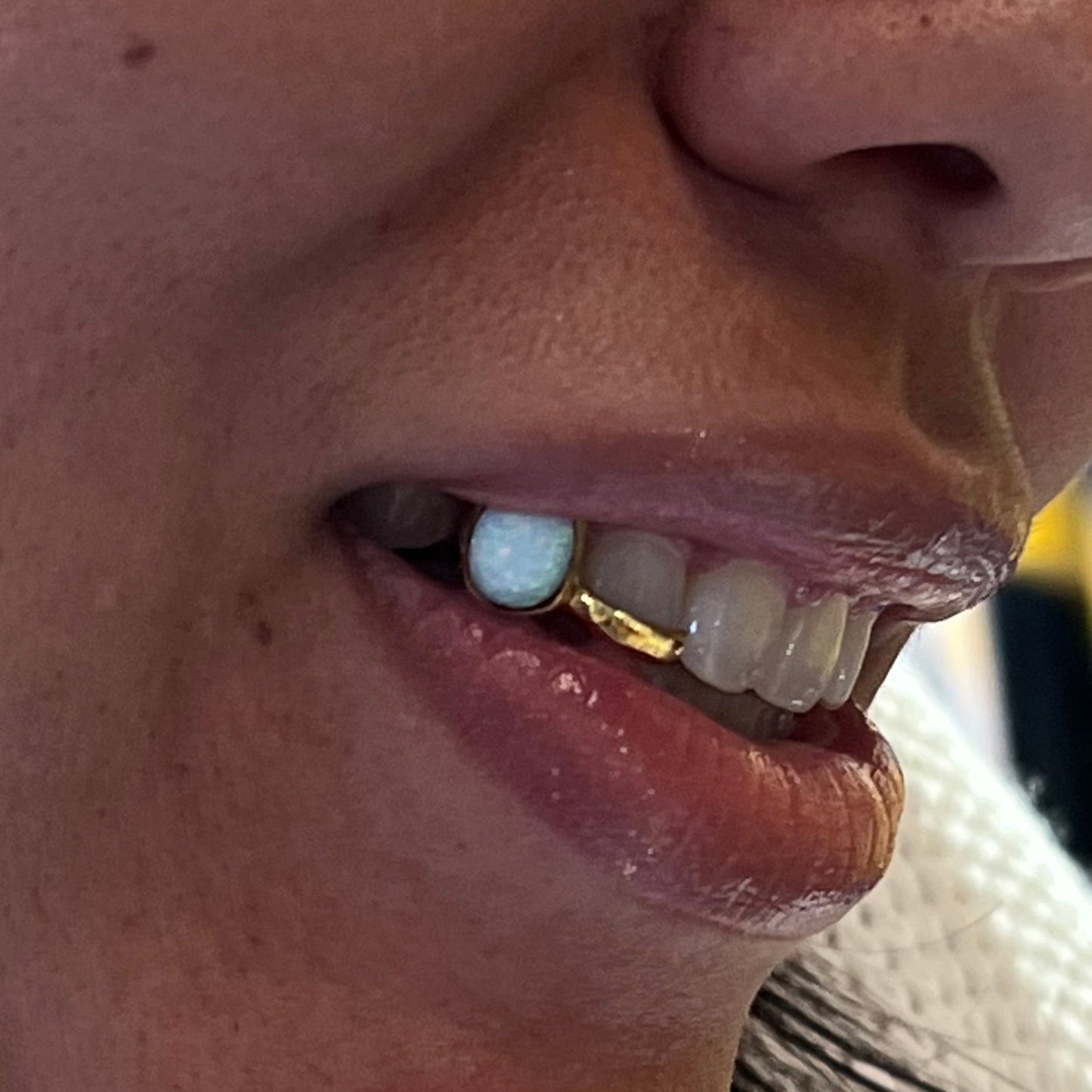 OPAL TEETH 2 PIECE