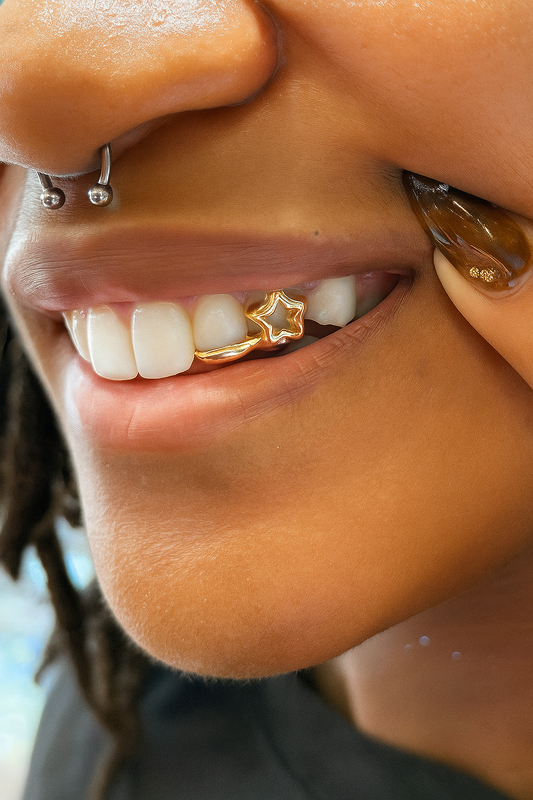 Custom Gold Star Grillz