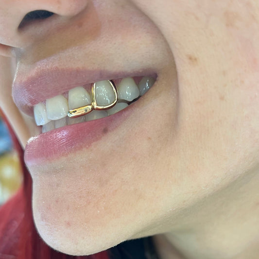 2PIECE OPEN FACE AND BAR