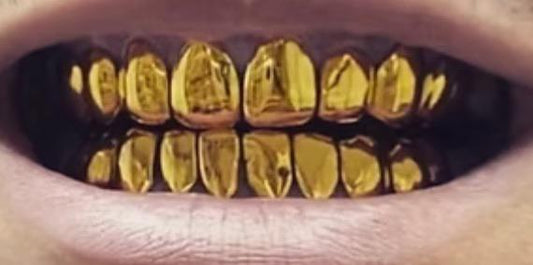 Biggest 314 DAY Sale – NPG Sets Only!