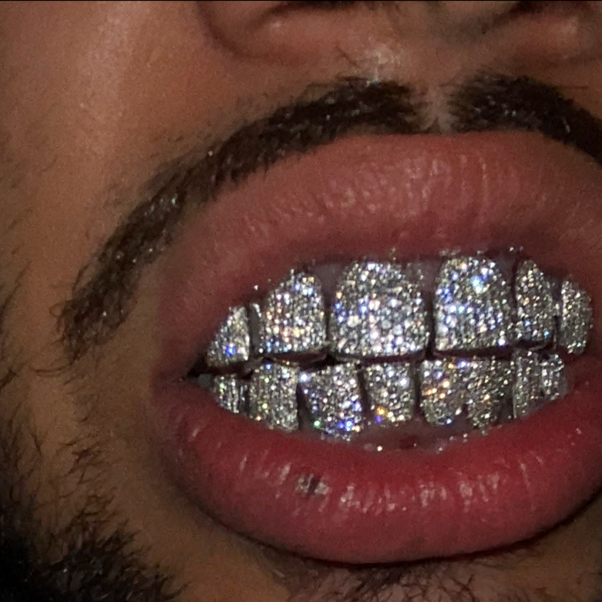 VS Diamond Flush (Sold Per Tooth)